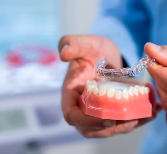 Aparat nakładkowy Invisalign Warszawa