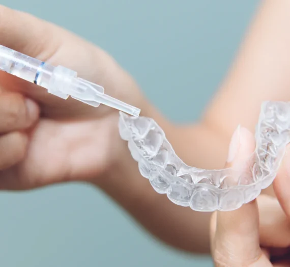 Aparat Invisalign Warszawa